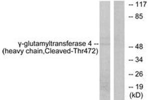 Western Blotting (WB) image for anti-gamma-Glutamyltransferase 7 (GGT7) (AA 423-472), (Cleaved-Thr472) antibody (ABIN2891196) (GGT7 抗体  (Cleaved-Thr472))