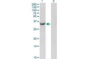 Western Blot analysis of AKR1C2 expression in transfected 293T cell line by AKR1C2 monoclonal antibody (M03), clone 3C11. (AKR1C2 抗体  (AA 224-323))