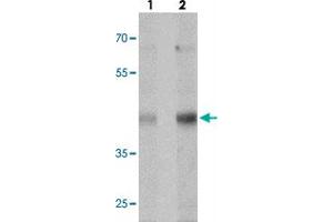 Western blot analysis of MTERFD1 in NIH/3T3 cell lysate with MTERFD1 polyclonal antibody  at (lane 1) 1 and (lane 2) 2 ug/mL. (MTERFD1 抗体  (C-Term))