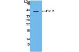 Western blot analysis of recombinant Human ABCA4. (ABCA4 抗体  (AA 1398-1727))