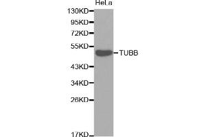 Western blot analysis of extracts of HeLa cells, using TUBB antibody (ABIN5974698). (TUBB1 抗体)