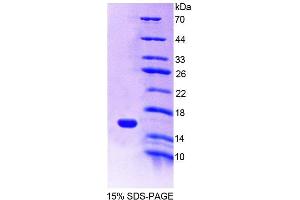 SDS-PAGE analysis of Mouse MIA1 Protein. (MIA 蛋白)