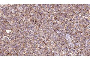 Immunohistochemistry (IHC) image for anti-Solute Carrier Family 22 (Organic Anion/urate Transporter), Member 12 (SLC22A12) antibody (ABIN6265903)