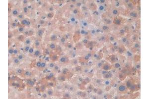 Detection of MAOA in Mouse Liver Tissue using Polyclonal Antibody to Monoamine Oxidase A (MAOA)