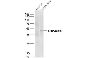 Lane 1: EC9706 lysates Lane 2: mouse lymph node lysates probed with IL2RA Polyclonal Antibody, Unconjugated  at 1:500 dilution and 4˚C overnight incubation. (CD25 抗体  (AA 201-268))