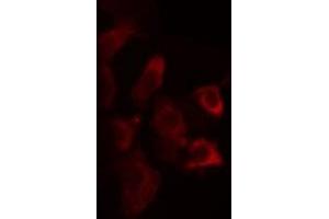 Immunofluorescence (fixed cells) (IF/ICC) image for anti-Zinc Finger, DHHC-Type Containing 2 (ZDHHC2) antibody (ABIN6259475)