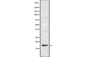 Western blot analysis of PGE synthase using Jurkat whole cell lysates (Prostaglandin E Synthase 抗体  (Internal Region))