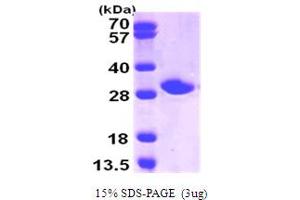 Nicotinamide N-Methyltransferase (NNMT) (AA 1-264) protein (His tag)