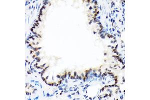 Immunohistochemistry of paraffin-embedded rat lung using DEK Rabbit mAb (ABIN7266724) at dilution of 1:100 (40x lens).