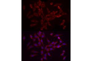 Immunofluorescence (IF) image for anti-Eukaryotic Translation Initiation Factor 4B (EIF4B) (AA 352-611) antibody (ABIN6140078)