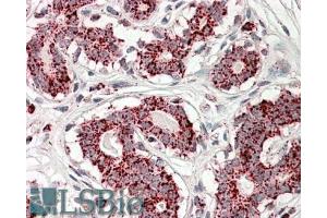 ABIN571124 (3. (ACO2 抗体  (Internal Region))
