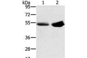 Western Blot analysis of Human placenta and plasma tissue using SLC13A3 Polyclonal Antibody at dilution of 1:200 (SLC13A3 抗体)