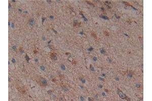 Immunohistochemistry (IHC) image for anti-Citrate Synthase (CS) (AA 103-394) antibody (ABIN7440647)