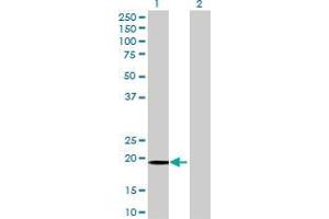 Lane 1: FUNDC2 transfected lysate ( 20. (FUNDC2 293T Cell Transient Overexpression Lysate(Denatured))