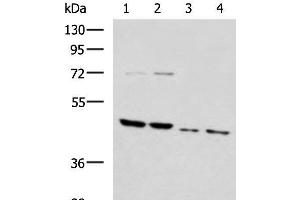 Western blot analysis of Rat brain tissue Mouse brain tissue Raji and 231 cell lysates using HTRA2 Polyclonal Antibody at dilution of 1:1000 (HTRA2 抗体)