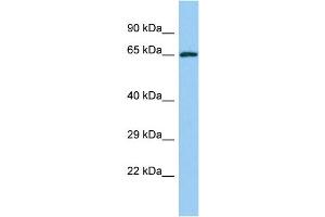 Host: Rabbit Target Name: YTHDF2 Sample Type: Jurkat Whole Cell lysates Antibody Dilution: 1. (YTHDF2 抗体  (C-Term))