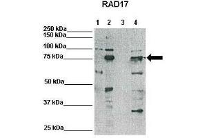 Western Blotting (WB) image for anti-RAD17 (RAD17) (N-Term) antibody (ABIN2779342)