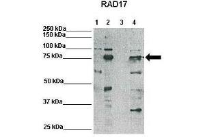 WB Suggested Anti-RAD17 Antibody    Positive Control:  Lane1: 25ug HeLa lysate, Lane2: 25ug Xenopus laevis egg extract, Lane3: 25ug mouse embryonic stem cell lysate, Lane4: 25ug HEK293T lysate   Primary Antibody Dilution :   1:500  Secondary Antibody :   Anti-rabbit-HRP   Secondry Antibody Dilution :   1:3000  Submitted by:  Domenico Maiorano, Institute of Human Genetics, CNRS (RAD17 抗体  (N-Term))