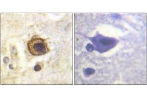Immunohistochemistry analysis of paraffin-embedded human brain tissue, using PDGFR beta (Ab-1021) Antibody. (PDGFRB 抗体  (AA 991-1040))