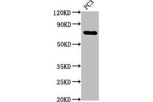 Western Blot Positive WB detected in: PC3 whole cell lysate All lanes: TP63 antibody at 2. (Recombinant p63 抗体)
