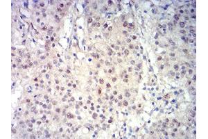 Immunohistochemistry (IHC) image for anti-B-Cell CLL/lymphoma 11B (Zinc Finger Protein) (BCL11B) (AA 1-150) antibody (ABIN5611301)