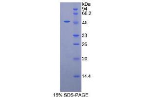 SDS-PAGE analysis of Human alpha Galactosidase Protein. (GLA 蛋白)