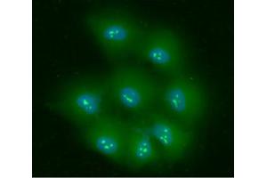 ICC/IF analysis of NPM in HeLa cells line, stained with DAPI (Blue) for nucleus staining and monoclonal anti-human NPM antibody (1:100) with goat anti-mouse IgG-Alexa fluor 488 conjugate (Green).