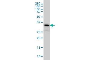 Western Blotting (WB) image for anti-PIH1 Domain Containing 1 (PIH1D1) (AA 1-290) antibody (ABIN565804)