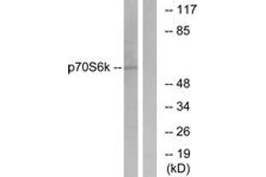 Western blot analysis of extracts from HeLa cells, treated with Insulin 10mU/ml 5', using p70 S6 Kinase (Ab-411) Antibody. (RPS6KB1 抗体  (AA 401-450))