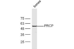 Mouse Bone lysates probed with PRCP Polyclonal Antibody, Unconjugated  at 1:300 dilution and 4˚C overnight incubation. (PRCP 抗体  (AA 101-200))