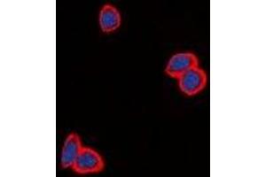 Immunofluorescent analysis of EGFR staining in MCF cells. (EGFR 抗体  (C-Term))
