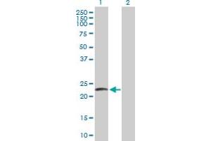 Western Blot analysis of LYZL2 expression in transfected 293T cell line by LYZL2 MaxPab polyclonal antibody. (Lysozyme-Like 2 抗体  (AA 1-194))