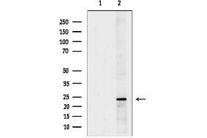 anti-Neurturin (NRTN) (C-Term) antibody