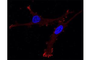 Immunocytochemistry (ICC) image for anti-Zyxin (ZYX) (AA 352-357) antibody (ABIN1742558) (ZYX 抗体  (AA 352-357))