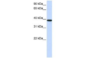 WB Suggested Anti-KLHDC8B Antibody Titration:  0. (KLHDC8B 抗体  (Middle Region))