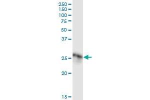Immunoprecipitation (IP) image for anti-Complement Component 1, Q Subcomponent, A Chain (C1QA) (AA 1-245) antibody (ABIN513850)