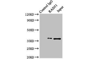 Immunoprecipitating RAD51 in K562 whole cell lysate Lane 1: Rabbit control IgG (1 μg) instead of ABIN7150287 in K562 whole cell lysate. (RAD51 抗体  (AA 1-228))