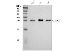 Western blot analysis of SNAP23 using anti-SNAP23 antibody (ABIN7599089).
