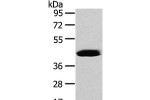 Western Blot analysis of Hela cell using VASH2 Polyclonal Antibody at dilution of 1/450 (Vasohibin 2 抗体)