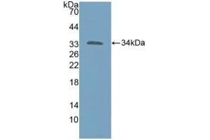 Detection of Recombinant KATNA1, Human using Polyclonal Antibody to Katanin P60 Subunit A 1 (KATNA1) (KATNA1 抗体  (AA 8-229))
