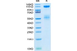 Biotinylated Human IGF1R on Tris-Bis PAGE under reduced condition. (IGF1R Protein (AA 31-932) (His-Avi Tag,Biotin))