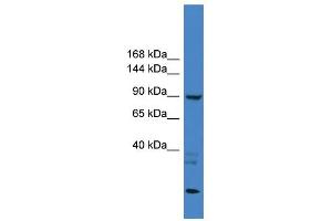 WB Suggested Anti-TLR4 Antibody Titration: 0. (TLR4 抗体  (Middle Region))