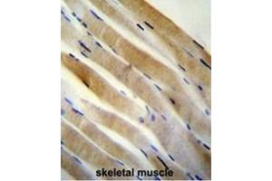 Immunohistochemistry (Paraffin-embedded Sections) (IHC (p)) image for anti-Protein Kinase, AMP-Activated, alpha 2 Catalytic Subunit (PRKAA2) (AA 148-177), (Middle Region), (Thr172) antibody (ABIN954298)