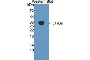 Detection of Recombinant GAB2, Mouse using Polyclonal Antibody to GRB2 Associated Binding Protein 2 (GAB2) (GAB2 抗体  (AA 357-607))