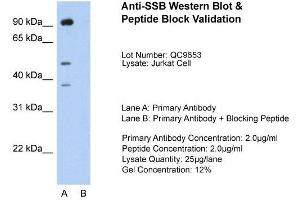 Host:  Rabbit  Target Name:  SSB  Sample Type:  Jurkat  Lane A:  Primary Antibody  Lane B:  Primary Antibody + Blocking Peptide  Primary Antibody Concentration:  2. (SSB 抗体  (N-Term))