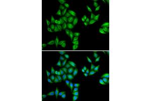 Immunofluorescence analysis of HeLa cells using BTG1 antibody (ABIN5973768). (BTG1 抗体)