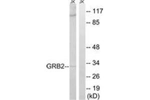 Western blot analysis of extracts from Jurkat cells, using GRB2 Antibody. (GRB2 抗体  (AA 141-190))