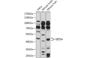 Western blot analysis of extracts of various cell lines, using SETD4 antibody (ABIN7270264) at 1:1000 dilution. (SETD4 抗体  (AA 210-300))