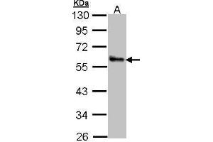 WB Image Sample (30 ug of whole cell lysate) A: A431 , 10% SDS PAGE antibody diluted at 1:1000 (ZNF259 抗体  (Center))