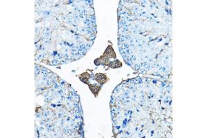 Immunohistochemistry of paraffin-embedded mouse testis using IDS Rabbit pAb (ABIN3015633, ABIN3015634, ABIN3015635 and ABIN6218988) at dilution of 1:200 (40x lens). (IDS 抗体  (AA 34-290))
